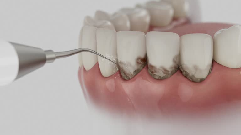 Reliable Tooth Extraction contractor in Oakdale, CA by Smile Center Dentistry